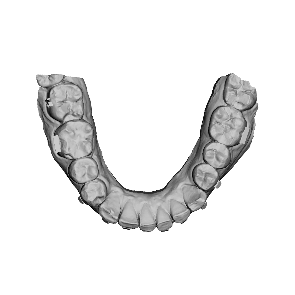 Aligners Design