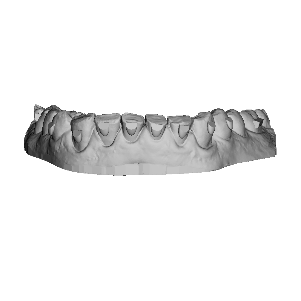 Aligners Design