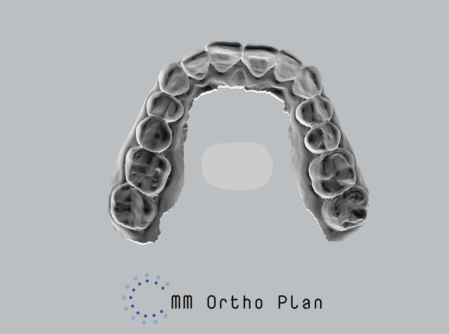 Printed STL model