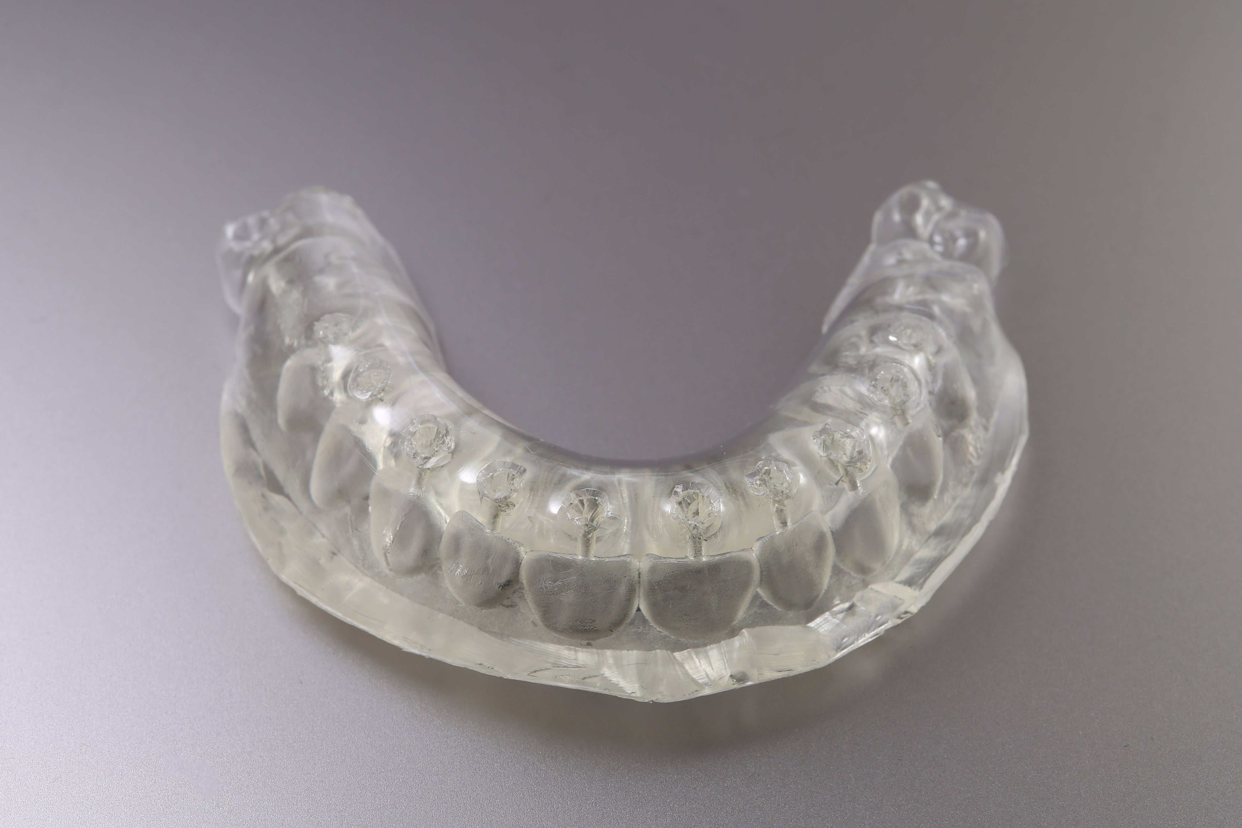 Stent covering teeth for composite bonding – MM Ortho Plan LTD